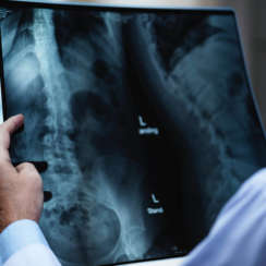 Radiografia e risonanza magnetica: quali sono le differenze