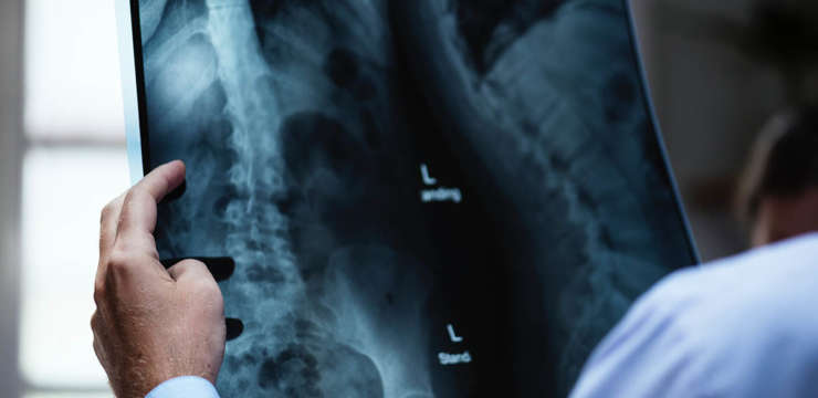 Radiografia e risonanza magnetica